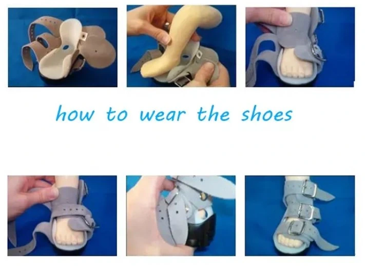 Denis Brown Splint Shoes Orthopedic Shoes for Clubfoot Footwear Corrective Kids